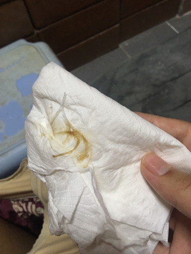 ขออภัยรูปด้วยนะคะ ท้อง 39 week มีมูกแบบนี้ต้องไปโรงพยาบาลเลยมั้ยคะไม่มีอาการปวดท้องไม่มีน้ำเดิน