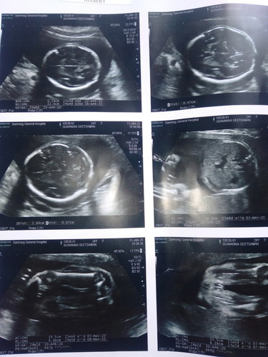 ภาพแรกของหนู 25+2