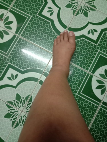 หาวิธีแก้เท้าบวม