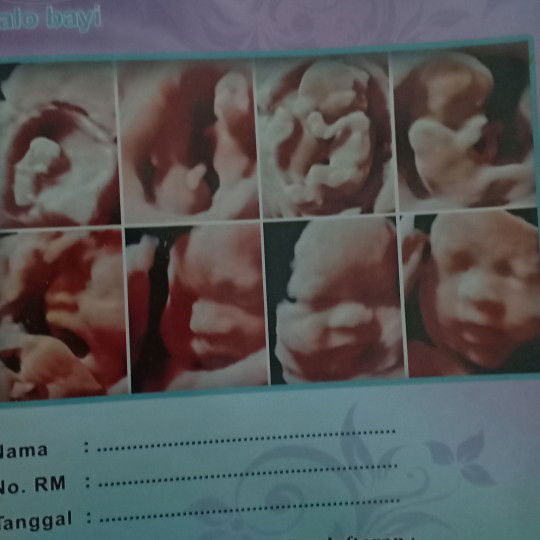 pertanyaan untuk konsul kehamilan di waktu 5 bulan