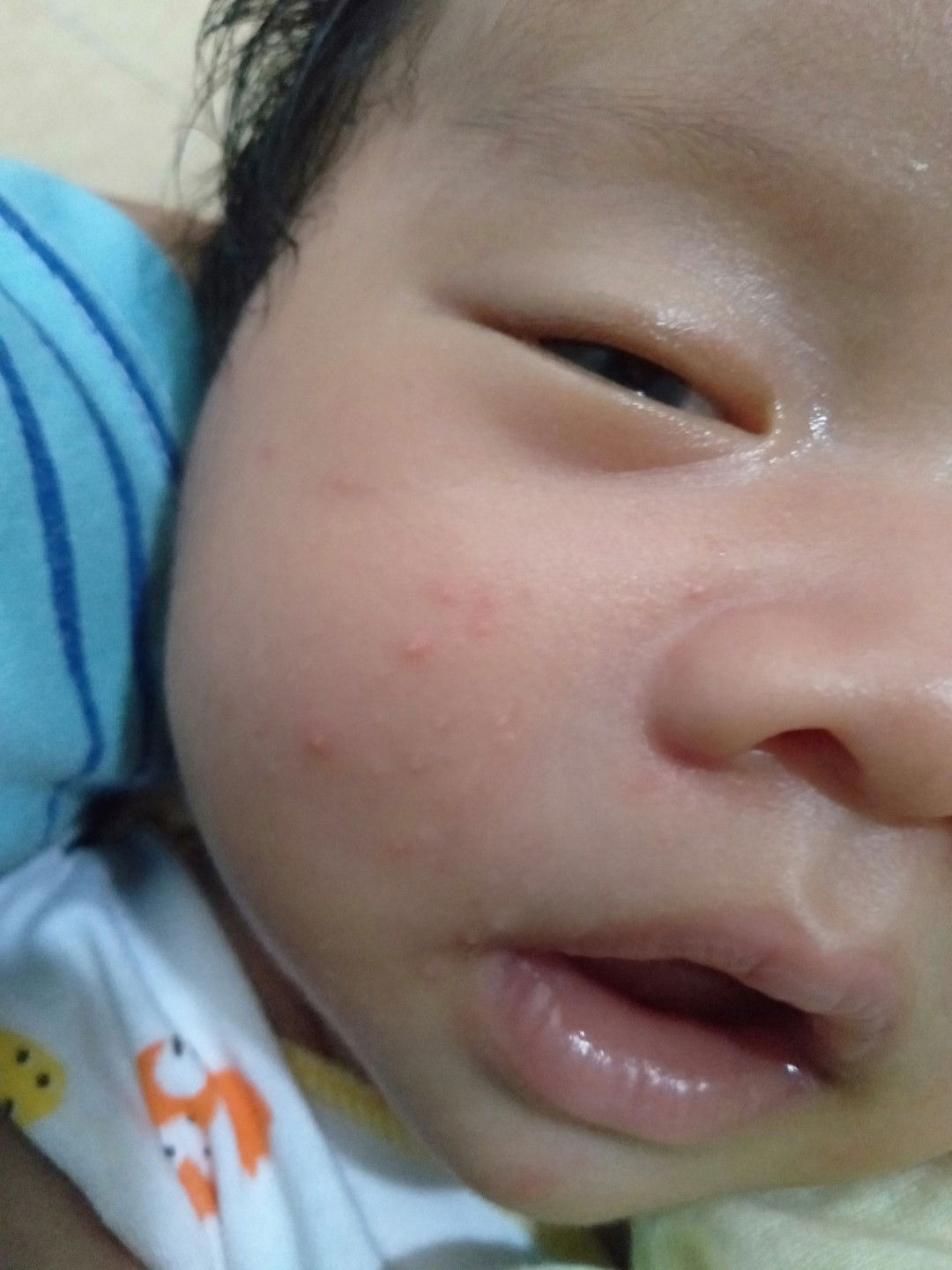 Bintik kecil seperti jerawat