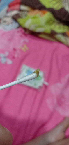 น้องคลอดได้23วัน มีขี้มูกสีเขียวเหลืองแบบนี้อันตรายมั้ยค่ะ