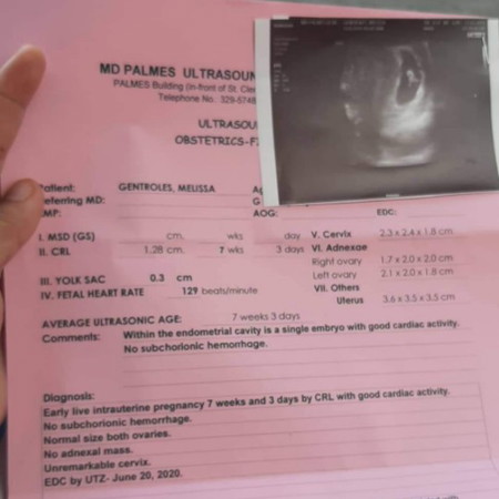 preggy