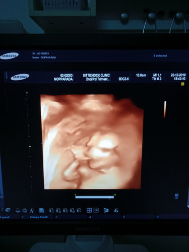 ซาวด์รอบที่2ครับผม