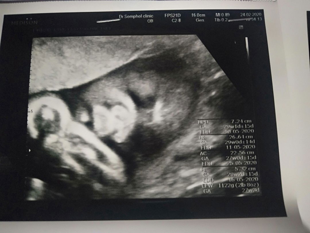 น้องอาย profile icon