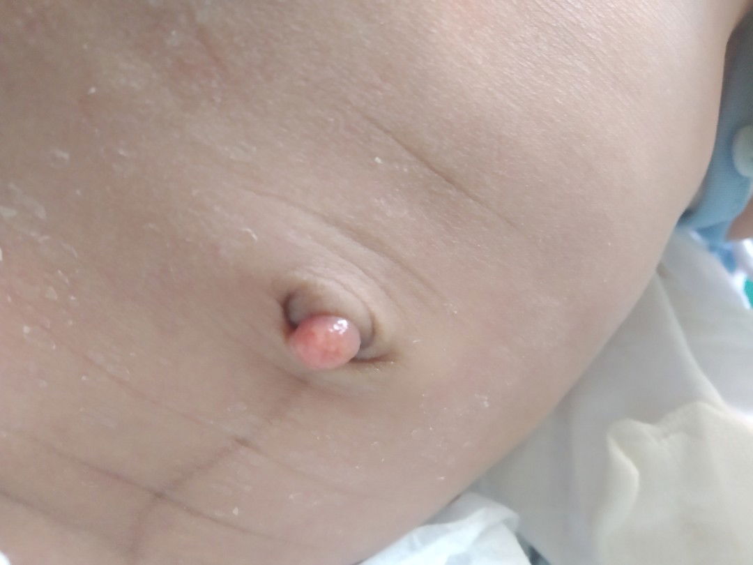 pusar nonjol dan blum kering²