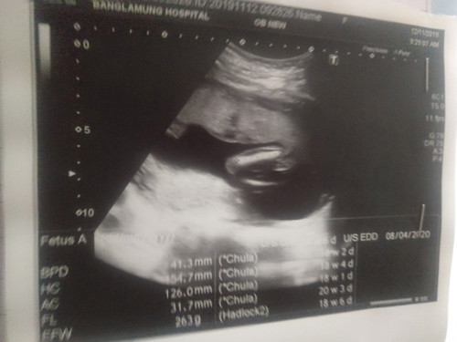 แบบนี้ผู้หญิงหรือผู้ชายค่ะ