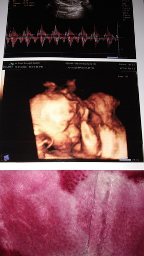 24week