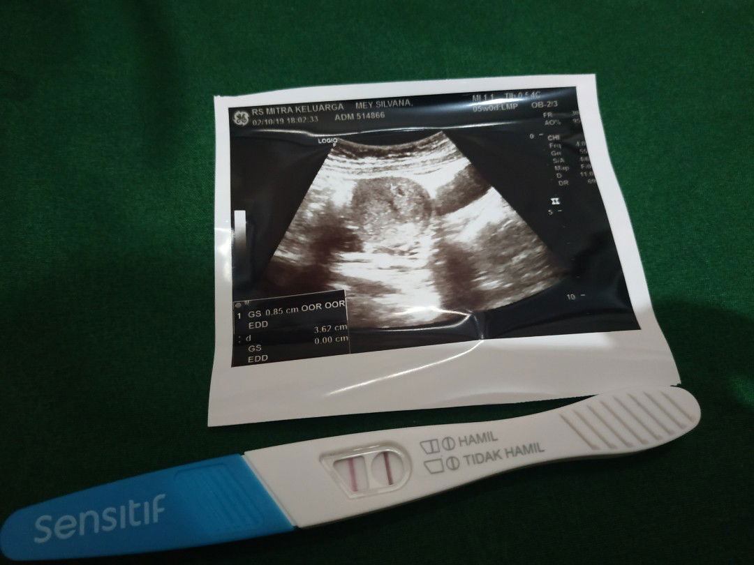 pengalaman hamil