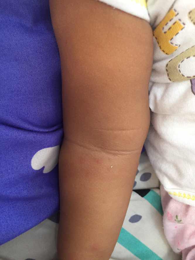 Alergi atau bukan ya