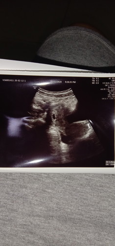 pregnancy