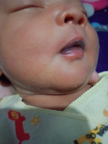 baby 2 minggu