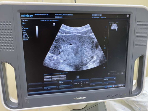 แม่ๆท่านไหนคลอดเดือนมกราบ้างคะ