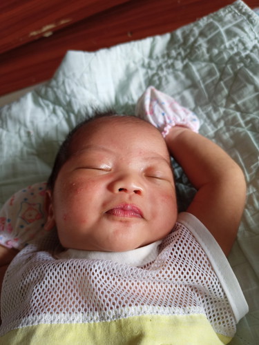 ตุ่มขึ้น