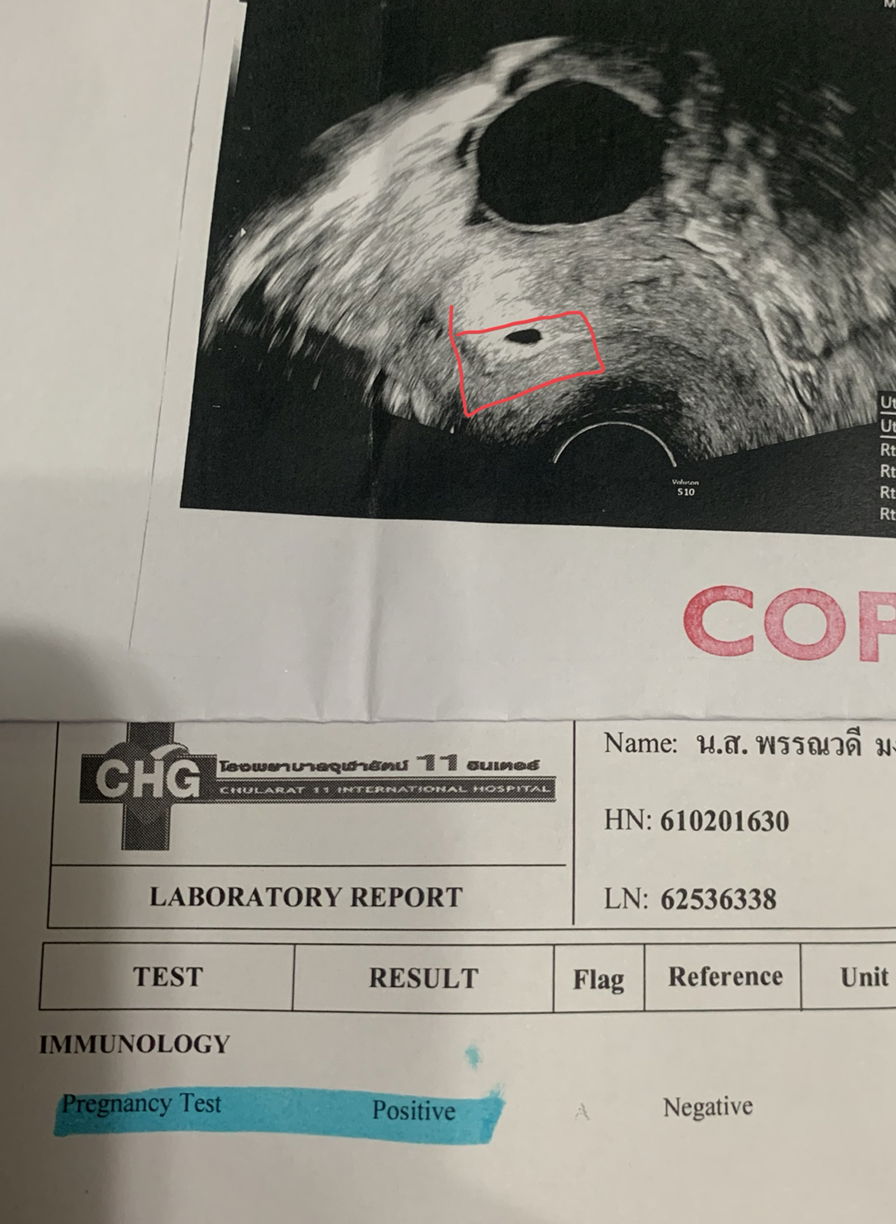 เป็นประจำเดือน แต่ท้อง..