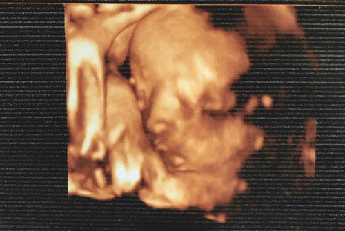 อยากขอประสบการณ์แม่ๆที่คลอดธรรมชาติหน่อยค่ะ