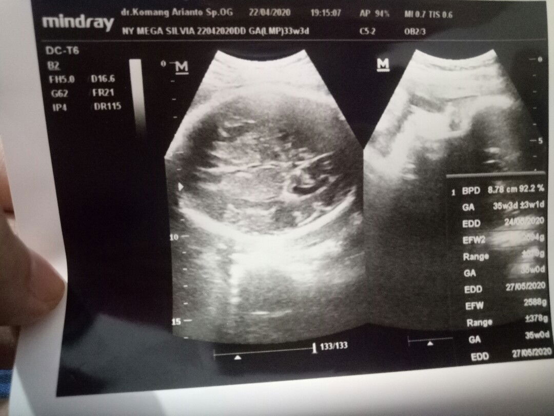 usia dan bb janin