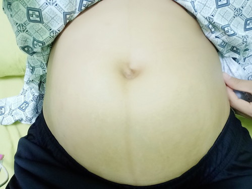 ทีม มิถุนายน 21+1week ท้องเล็กไปไหมค่ะ
