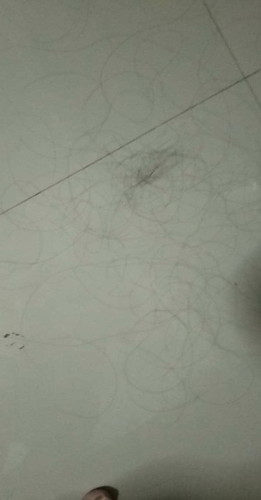 พึ่งคลอดน้องจะเข้า5เดือนแล้วค่ะผมร่วงมากเลยค่ะแม่ๆบ้านไหนเป็นบ้างค่ะ