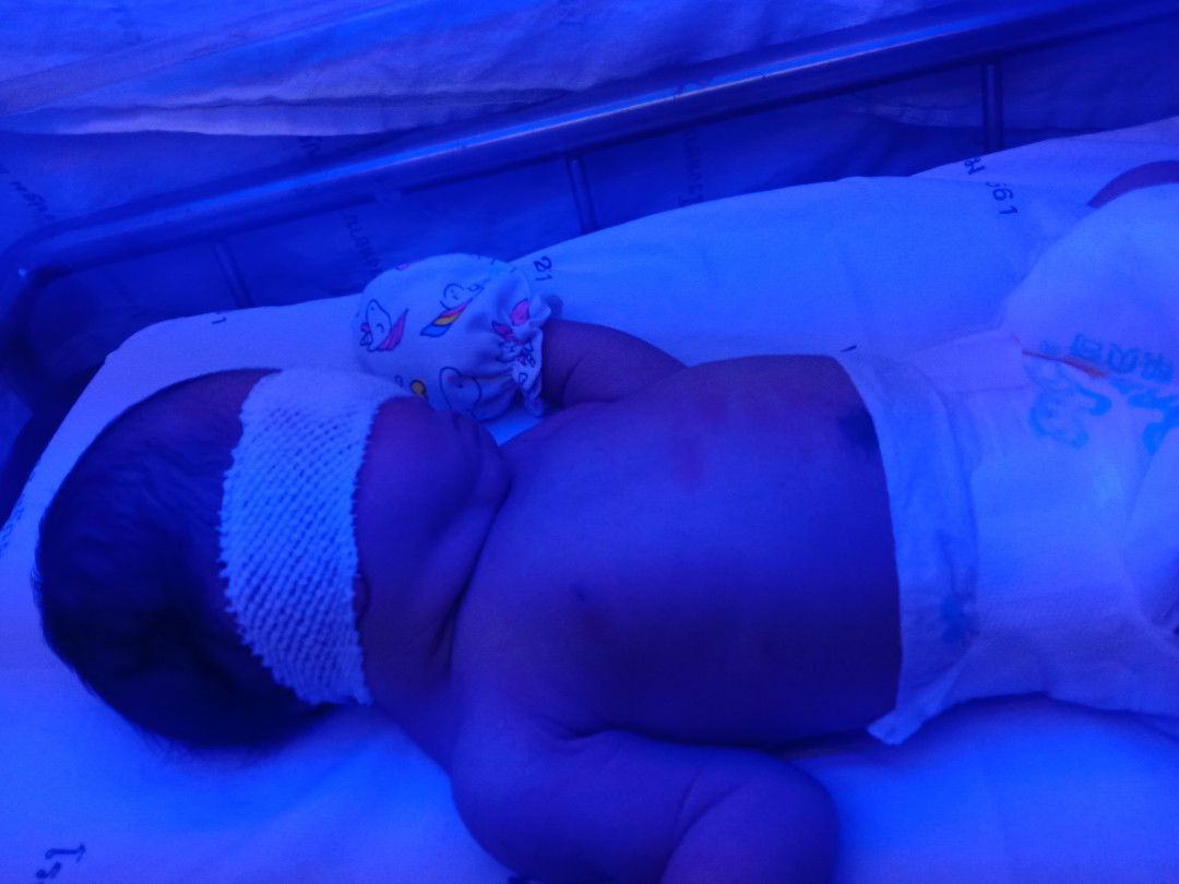 ลูก 4 วัน เพิ่งเริ่มทานมผงวันแรก