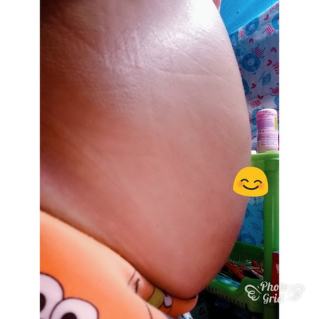 18สัปดาท้องเล็กไหมค่ะ