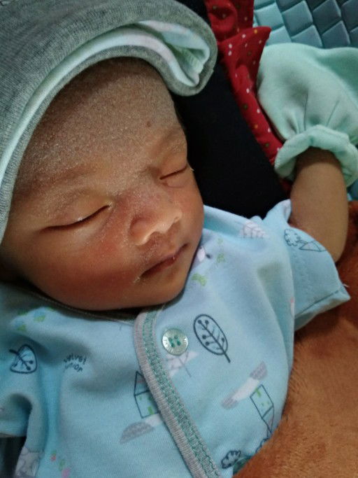 kulit bayi