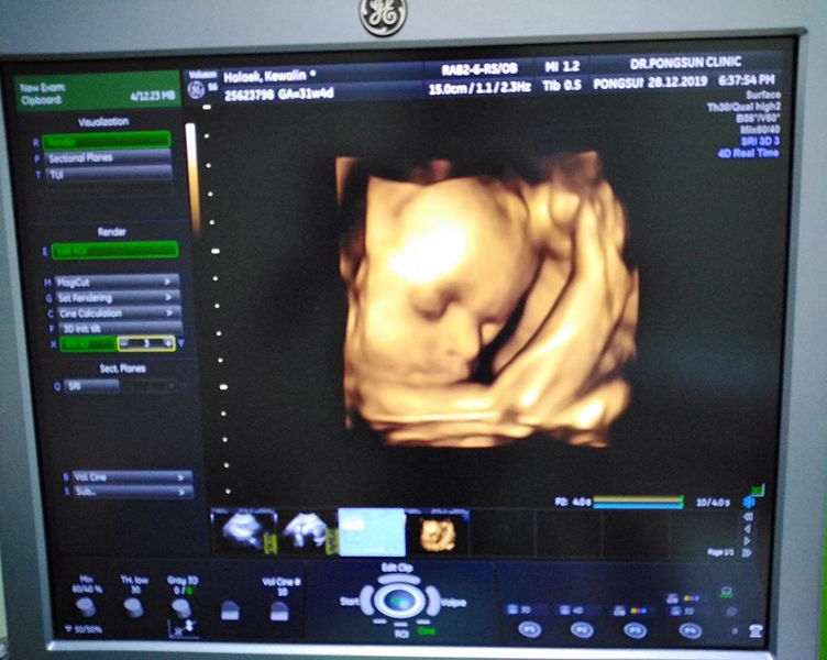 สวีท เลม่อน profile icon