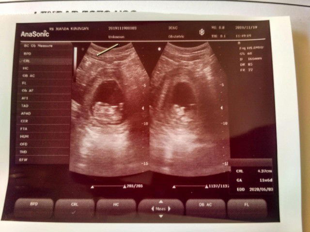 risna melawati profile icon