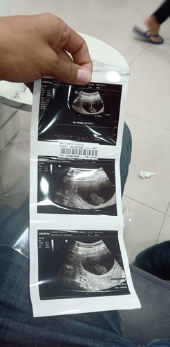 9week3d