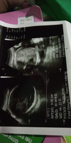 usia kndungan sama bb debay segitu normal ngga sih bun?