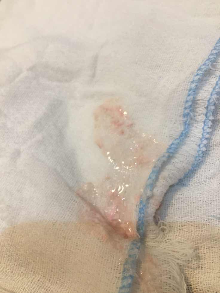 lungad pareply naman agad please