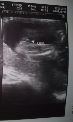 girl o boy?