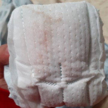 มีเลือดออกสีน้ำตาลจางๆ