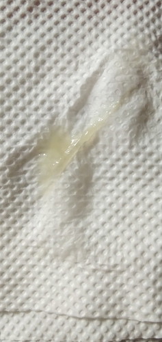 Amniotic fluid po ba ito? Parang sipon.