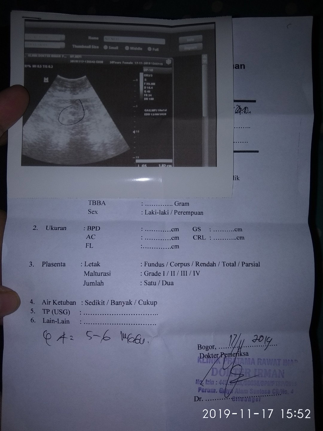 5-6 weeks