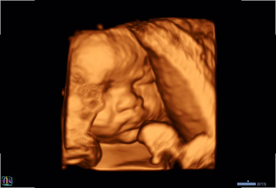 iin oktavianti profile icon