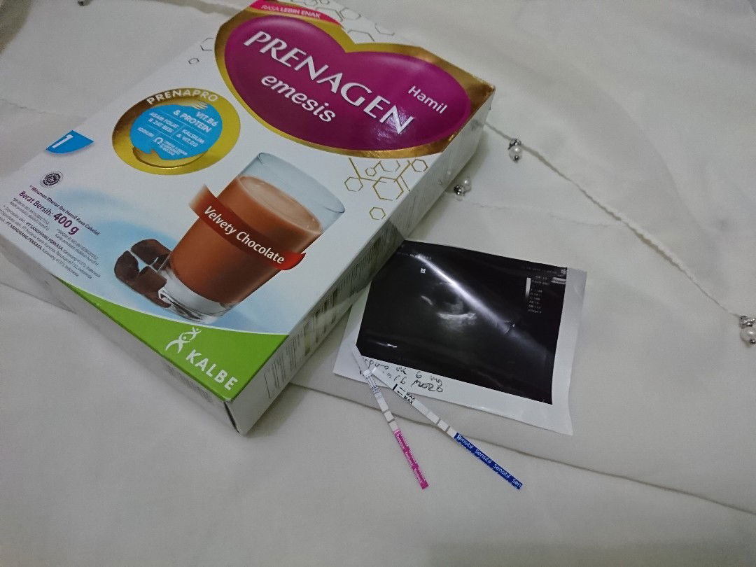 Rezeki Yg Luar Biasa