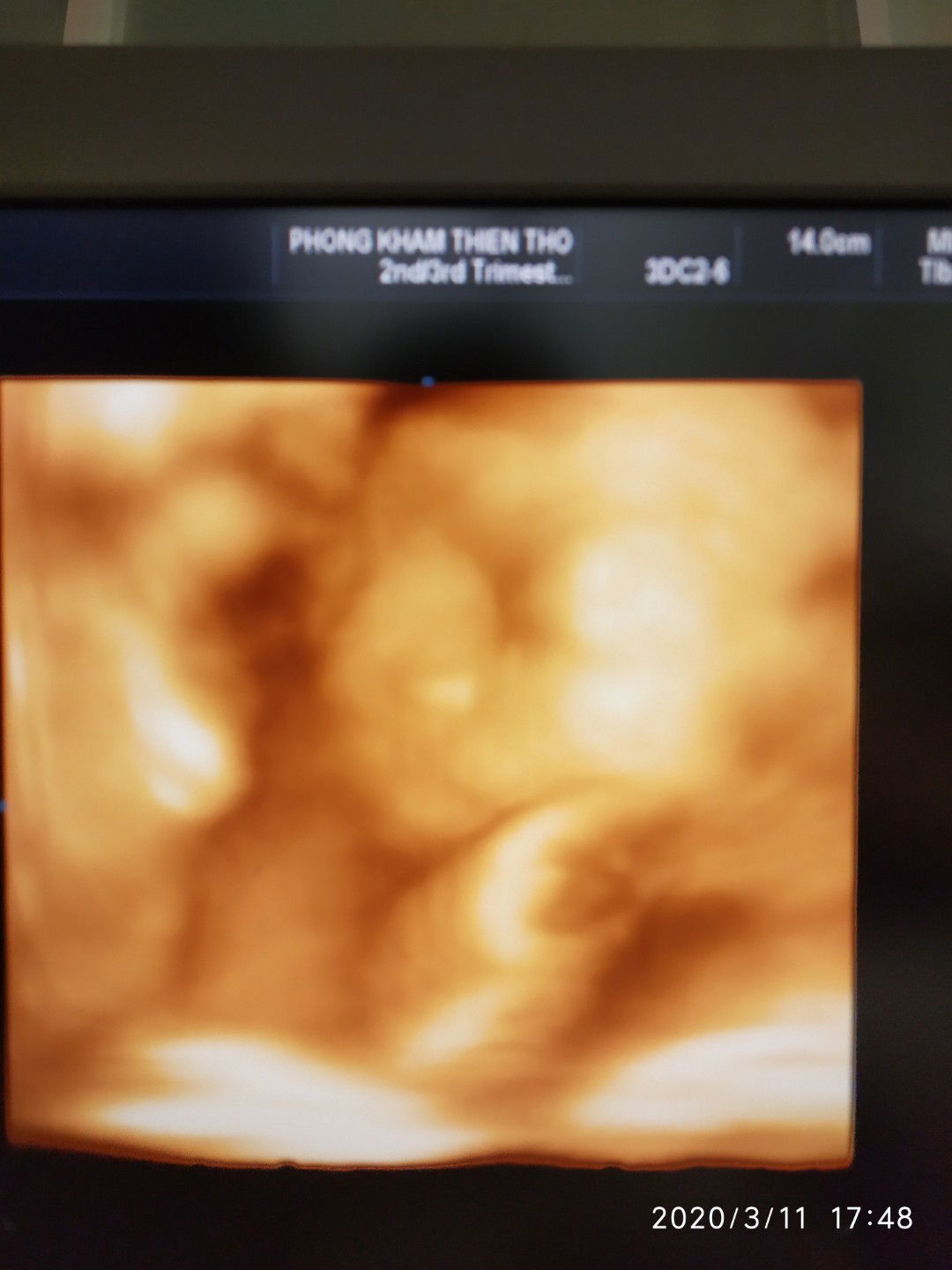 Beer của ba mẹ ❤️