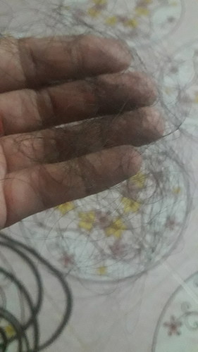 หลังคลอดแม่บ้านไหนผมร่วงบ้างคะ