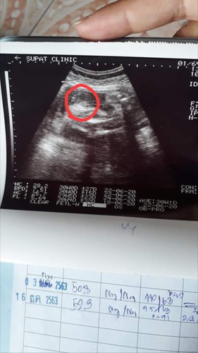 ช่วยดูเพศน้องหน่อยค่ะ