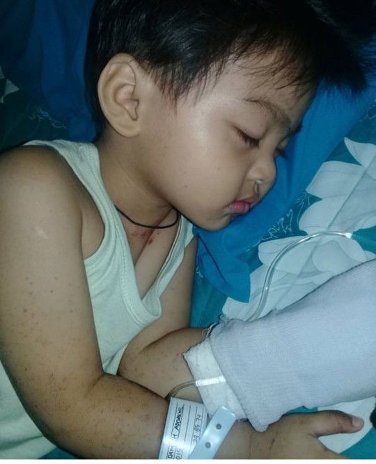 Berbagi pengalaman dengan anak yg menderita autoimun