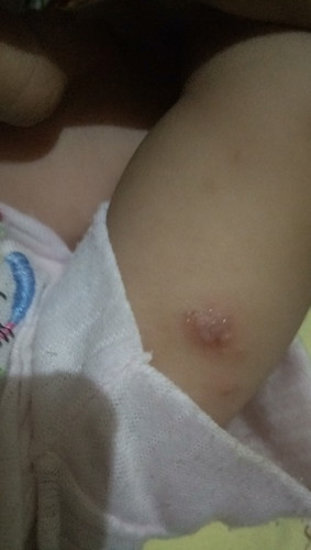 bayi gatel umur 4bln