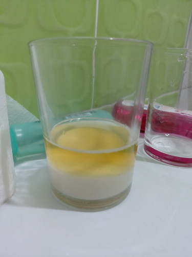 ทายเพศลูก