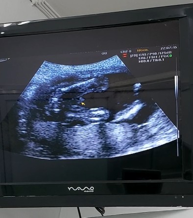 ลูกชายหรือลูกสาว