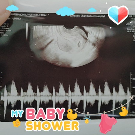 แม่ท้องแรก