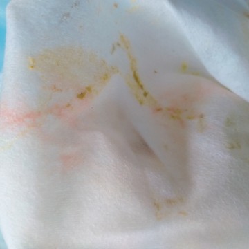 ทายออกมาเป็นเลือด