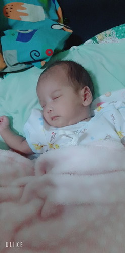 เท้าบวม