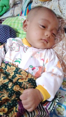 gigitan nyamuk
