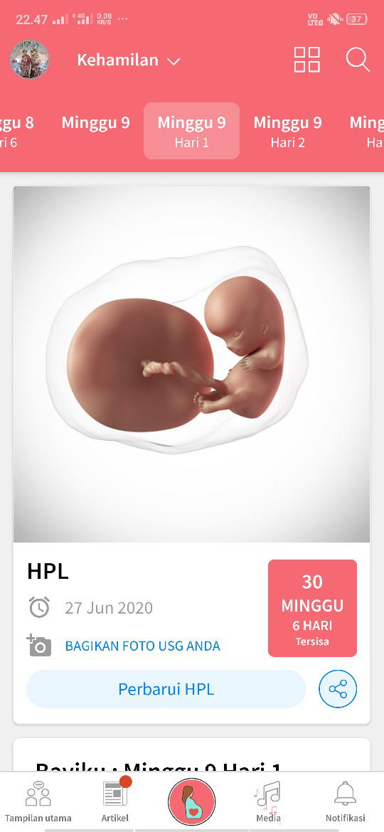 Innalillah, Keguguran spontan 