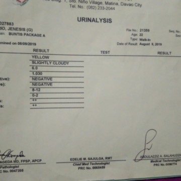 URINALYSIS RESULT